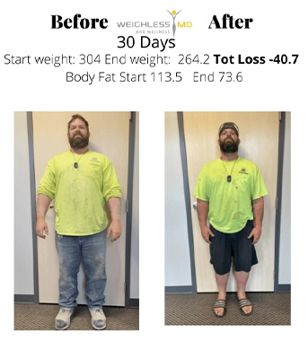 Weight Loss Middle GA Before And After