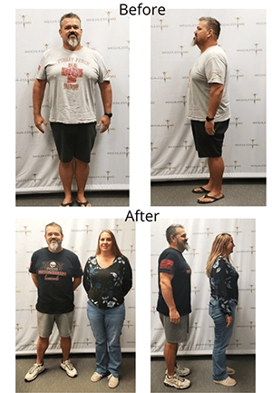 Weight Loss Middle GA Before And After