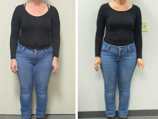 Weight Loss Middle GA Before And After