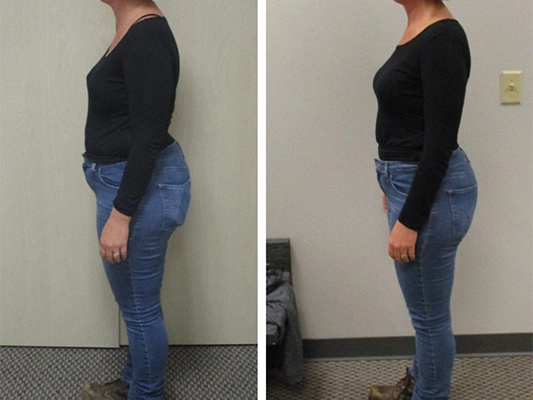 Weight Loss Middle GA Before And After