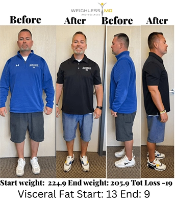 Weight Loss Middle GA Before And After