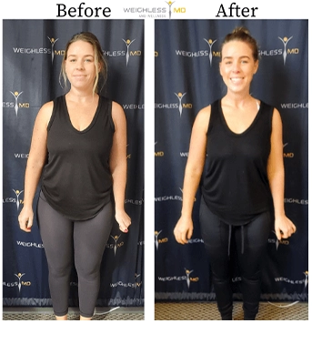 Weight Loss Middle GA Before And After